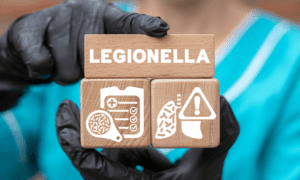 legionella water treatment testing